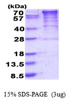 AR51657PU-N - EEF-2 kinase