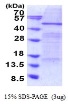 AR51666PU-N - ELP4