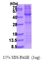 AR51742PU-N - TRIB3