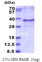 AR51774PU-N - Endothelin-3