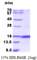 AR51836PU-N - Otoraplin