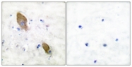 A0083-1 - FAK2 / PTK2B