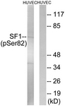 A0572-1 - Splicing factor 1 (SF1)