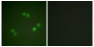 A0572-1 - Splicing factor 1 (SF1)