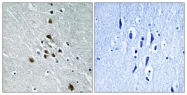 A0572-1 - Splicing factor 1 (SF1)