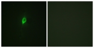 A0641-1 - EIF4B