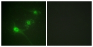 A0672-1 - STK11