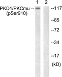 A0721-1 - PRKD1