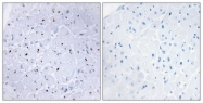 A0760-1 - TP53BP1