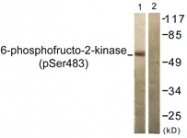 A0761-1 - PFKFB2