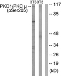 A0806-1 - PRKD1