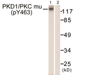 A0807-1 - PRKD1