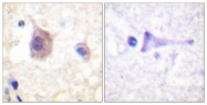 A0807-1 - PRKD1