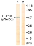 A0809-1 - PTPN1