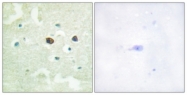 A0809-1 - PTPN1