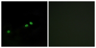 A0858-1 - CENP-A