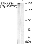 A0914-1 - EPHA2 / ECK