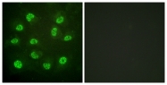 A0922-1 - Estrogen receptor beta