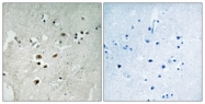 A0923-1 - ELK3
