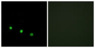 A0930-1 - FOSB