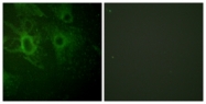 A0938-1 - HCK