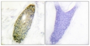 A0939-1 - HDAC3