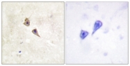 A0952-1 - IFNAR1