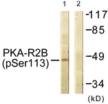 A0972-1 - PRKAR2B