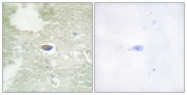 A1127-1 - TGFBR2
