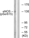 A1145-1 - NOS3