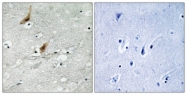 A8149-1 - MSK2