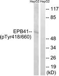 A8341-1 - EPB41 / Protein 4.1