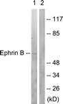 B0010-1 - Ephrin-B1
