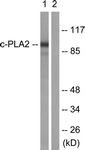 B0065-1 - PLA2G4A