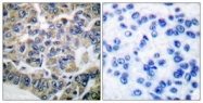 B0071-1 - EEF-2 kinase
