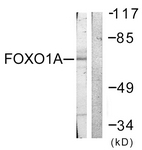 B0484-1 - FOXO1A