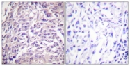 B0484-1 - FOXO1A