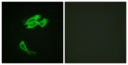 B0545-1 - PEA15