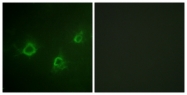 B0551-1 - PLCG1