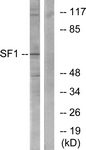 B0572-1 - Splicing factor 1 (SF1)