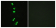 B0572-1 - Splicing factor 1 (SF1)