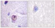 B0572-1 - Splicing factor 1 (SF1)