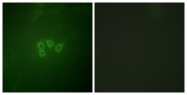 B0641-1 - EIF4B