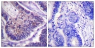 B0641-1 - EIF4B