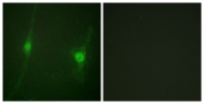 B0672-1 - STK11