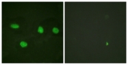 B0760-1 - TP53BP1