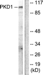 B0806-1 - PRKD1