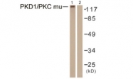 B0807-1 - PRKD1
