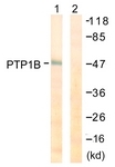 B0809-1 - PTPN1
