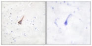 B0809-1 - PTPN1